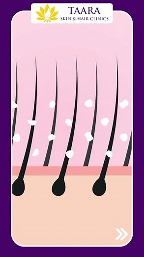 Struggling with dandruff and itchy scalp?