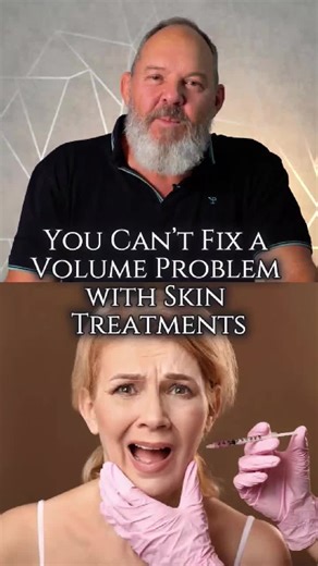 Not all facial concerns are the same, and not all treatments fix the same problem. Many patients come in saying they want their face to “look better,” but what they’re really experiencing usually falls into one of three areas: 💉loss of volume, 💉changes in skin quality, or 💉movement-related lines. If you’ve noticed sunken cheeks, under-eye hollows, or a face that looks less supported than it used to, that’s typically a volume concern. Treatments like peels, lasers, microneedling, or collagen s