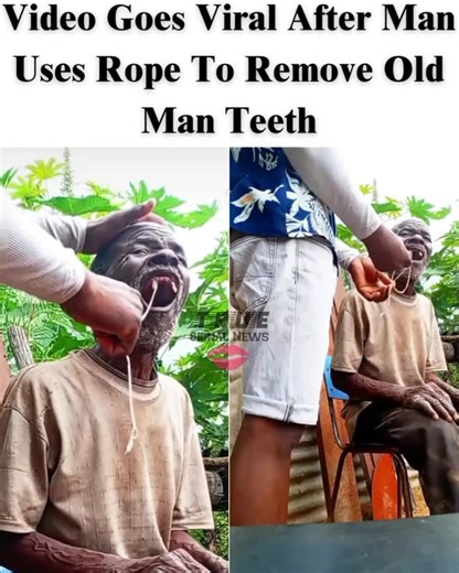Video Goes Viral After Man Uses Rope To Remove Old Man Teeth | True Signal News/TSN