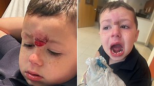 Pennsylvania dad demands answers after son, 5, has teeth knocked out in bloody assault at school, lawyer says