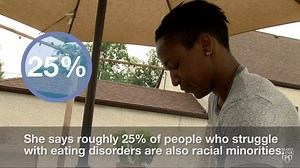 6.1K views · 47 reactions | It's the stereotypical image of an eating disorder: a young, white female who is extremely thin. But that's not always the case. "Eating disorders come in all shapes and sizes," says Dr. Leslie Sim. "For instance, 10% of anorexia cases and 30% of patients with binge-eating disorders are males." https://mayocl.in/2n5iXa7 | Mayo Clinic | Facebook