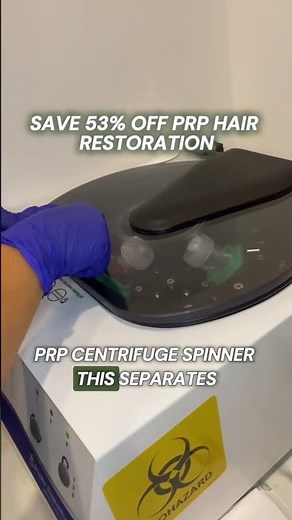 PRP Hair Restoration Explained: A Natural Approach to Thinning Hair