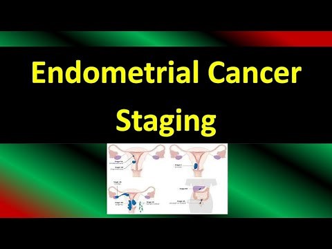 Endometrial Cancer Staging, FIGO Guideline 2023 (Updates)