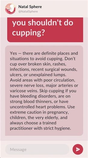 Is there anywhere you shouldn't do cupping?