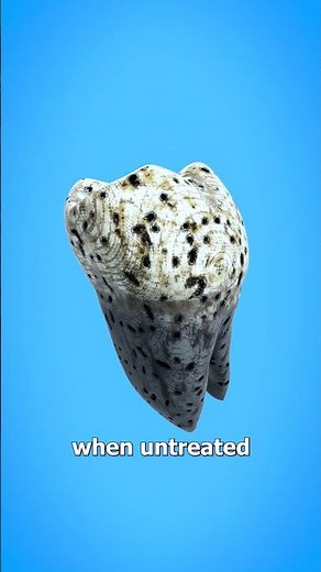 Why Teeth Used To Explode 🤯