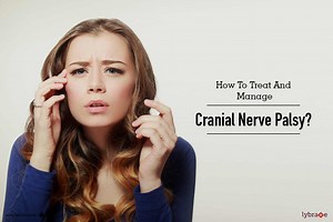 How To Treat And Manage Cranial Nerve Palsy? - By Dr. Rajeev  Sudan | Lybrate