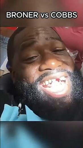 Tooth was broken.. Adrien BRONER vs Blair cobbs