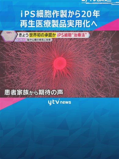 iPS細胞作製の発表から20年。厚生労働省の専門家部会で、製造販売が了承されれば、世界で初めて実用化される見通しです。#tiktokでニュース #読売テレビニュース