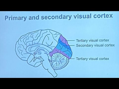 Stroke recovery vision