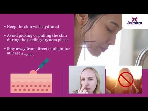 Remove stubborn warts safely with Electrolysis