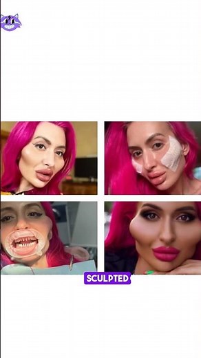 I Have The World’s Biggest Cheeks | Anastasia Pokreshchuk