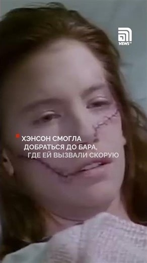 The Marla Hanson Story: Models Cut Their Faces for Rejecting Men