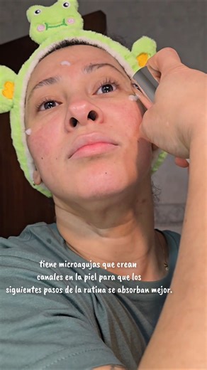 microagujas una adiccion!