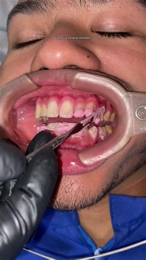 Dr. Bily Sáenz on TikTok