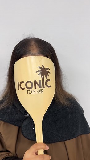 ✨Just a small parting… but a HUGE difference ✨ This little piece of Iconic SKINN has completely changed my girl’s confidence — lightweight, seamless, no-shave, and blends like a dream 🤍 ⭐️ Pros of Iconic SKINN: – Ultra flat undetectable finish – Custom tinted mapped to your scalp – Feels like your own hair (because it moves like it!) – No shaving or harsh adhesives – Game changer for thinning, alopecia or postpartum hair loss Whether you’re struggling with hair loss yourself or you’re a stylist