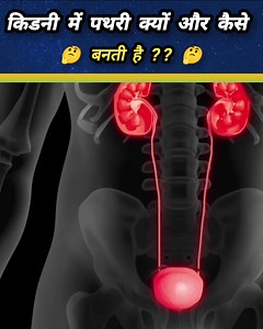 1.1M views · 9.3K reactions | किडनी में पथरी क्यों और कैसे बनती है樂।Kidney Stone and Gall Bladder Stone How Formation樂 #Kidneystones #gallbladder #Bodyfact #Sciencevideo | रोचक जानकारी | Facebook