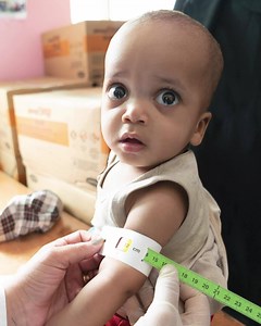 77 reactions | ⚠️ The coronavirus pandemic and child malnutrition are a deadly combination — but you have the power to save lives. Will you help a child like Mohammed? | World Food Programme | Facebook