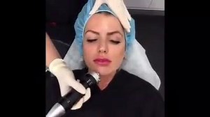 72K views · 185 reactions | Have you tried any of our specialised skin treatments? This is Fractional RF, a versatile treatment that works to rejuvenate your skin and visibly reduce imperfections. Check out all our skin treatments here: https://www.laserclinics.com.au/skin-treatments/ | Laser Clinics Australia | Facebook
