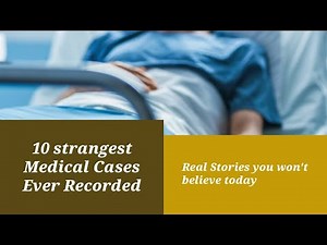 10 Strangest Medical Cases Ever Recorded | Real Stories You Won’t Believe