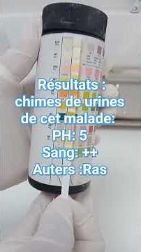 Comment effectuer une analyse d'urine