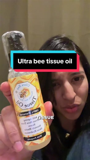 Not seen my son so happy and free in a long time! #tiktokmademebyit #tiktokshopuk #eczemauk #eczemamum #naturalskincare