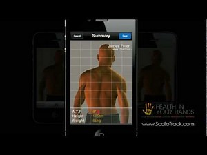 How to Use ScolioTrack | Detailed User Instruction | Tutorial Demo