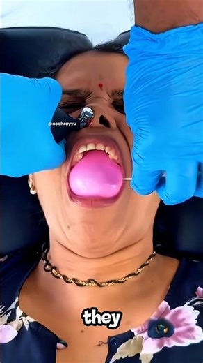 Doctors Inflate a Balloon in Your Nose ‼️😱