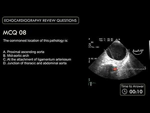 Echocardiography For Beginners | Echo Board Review MCQ 8 #echocardiogram