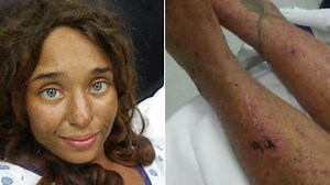 Woman Missing for a Month Found Naked on Rural Road, Survived on Berries and Muddy Water