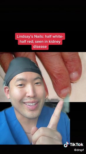 Understanding Nail Health and Its Connection to Chronic Diseases