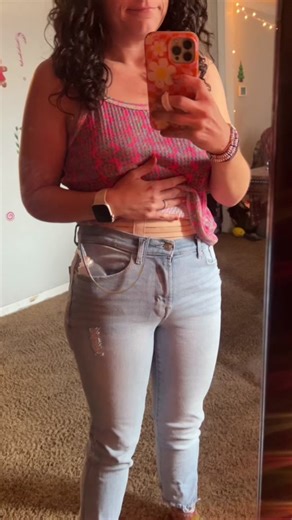 Post-Surgery Recovery: Two Weeks After Panniculectomy