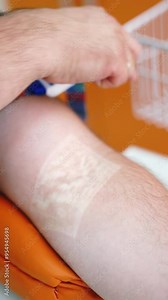 Close up of blood sampling. Doctor take blood sample from vein for testing. Vertical video