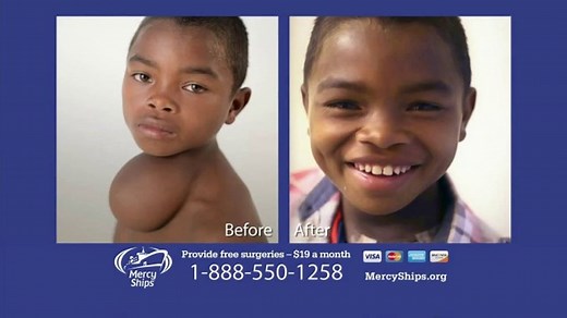 Mercy Ships TV Spot, 'Heartbreaking Stories'