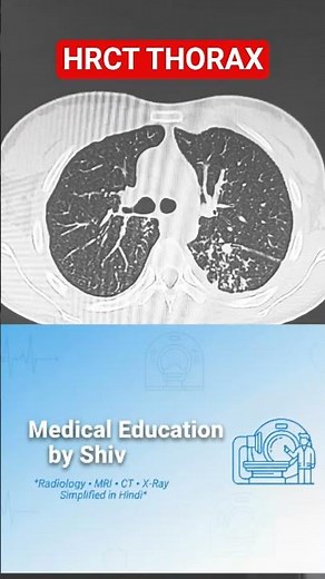 Mastering HRCT Thorax: The Ultimate Guide to Lung Imaging