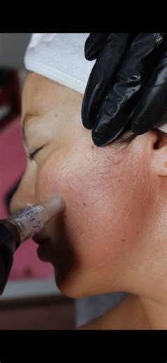 Microneedling doesn’t “thin” your skin. it actually strengthens it 👀 Those tiny channels signal your skin to rebuild collagen and elastin over time. So instead of breaking skin down, we’re telling it to repair regenerate. No shock. No overdoing it. Just smart stimulation and real results ✨