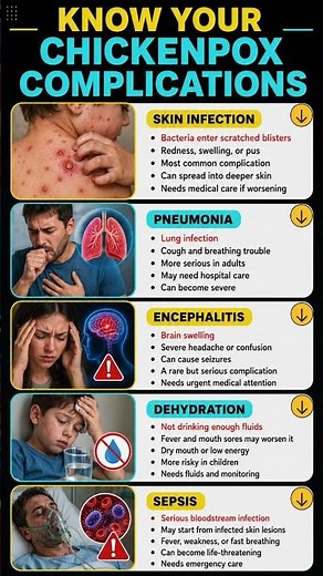 Is Chickenpox actually dangerous? #shorts #medical #science
