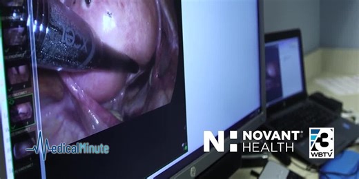 Understanding fibroid treatment options