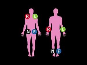 3 Lead ECG Placement（also including 5 lead ECG placement and 12 leads ECG placement）