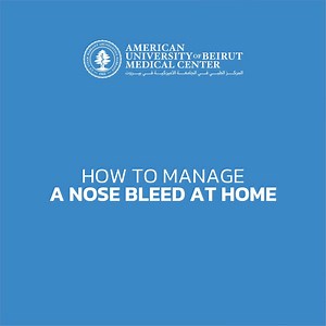 Are you suffering from frequent Nose Bleed? Learn more about the right way of managing it at home! For severe cases consult with your ENT physician at least once to identify the type of nose bleed you have and how to treat it. Otorhinolaryngology - Head & Neck Surgery Specialty Clinics. Halim and Aida Daniel Academic and Clinical Center 7th floor. Phone: 961 1 350 000 Ext. 5810 | Direct Line: 961 1 759636 #NoseBleed #Epistaxis #ENT | AUBMC - American University of Beirut Medical Center