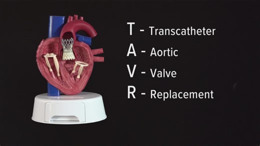 How TAVR is helping patients with heart valve problems