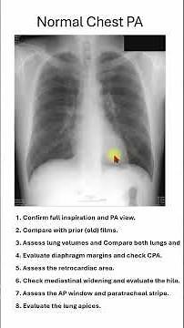 8. Chest X-ray Interpretation Checklist