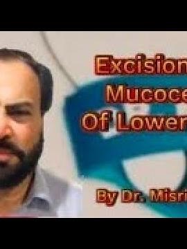 Surgical Removal (Excision) Of Mucocele Of Lower Lip