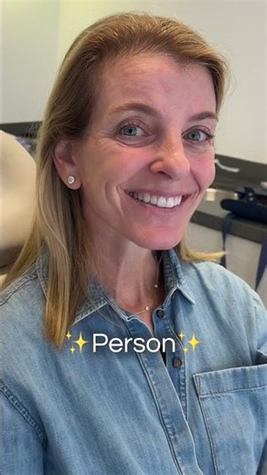 8 months post-op face and neck lift before and after #facelift #plasticsurgery