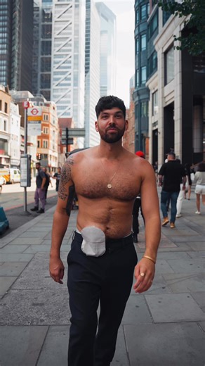 339K views · 7.6K reactions | Confidence doesn’t just happen. It’s taken me a while learning to live with my stoma, my body and everything in between. | Mr Colitis Crohns | Facebook