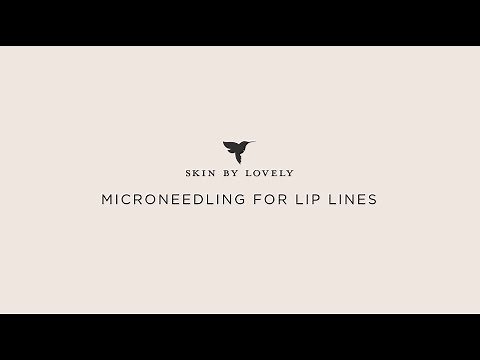Using microneedling for lip lines