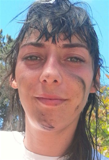Once I start treatment it’s over for you bitches & by bitches I mean trees,& by that I mean sick ones trees that need work no butchering here 🌲🌳 #treesurgeon #chainsaw ##womeninmalefields
