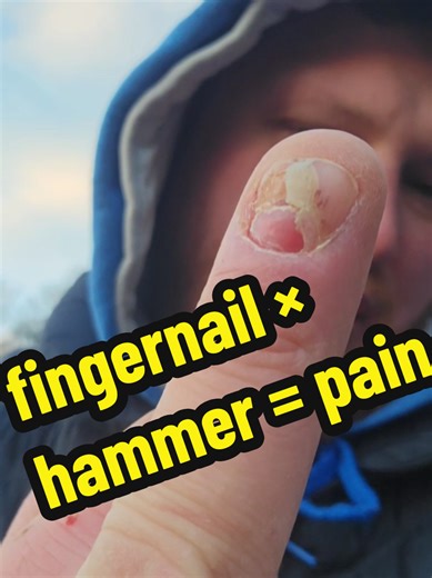 Avoiding Painful Mistakes While Hammering