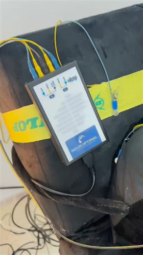 Nassima Lamdani Neurofeedback Alger on Instagram: "✨ Le neurofeedback : entraîner son cerveau naturellement ✨🧠 Le neurofeedback est une méthode douce et non invasive qui permet au cerveau d’apprendre à mieux fonctionner. Grâce à un retour en temps réel de son activité cérébrale, le cerveau s’auto-régule et retrouve progressivement son équilibre 🌿 👉 Les bienfaits du neurofeedback : ✔️ Réduction du stress et de l’anxiété ✔️ Amélioration du sommeil 😴 ✔️ Meilleure concentration et mémoire 🎯 ✔️