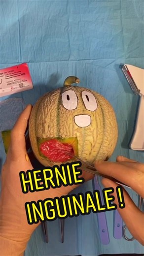 Opération d’une hernie inguinale en direct du bloc opératoire !