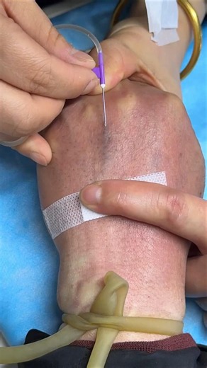 Intramuscular Injection Safely | Nurse-Level IM Injection Step-by-Step Training Guide Class 26